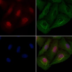 Invitrogen TRADD Polyclonal Antibody 100 μL; Unconjugated:Antibodies,