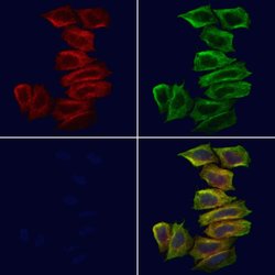 Invitrogen TRADD Polyclonal Antibody 100 μL; Unconjugated:Antibodies,