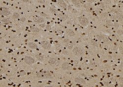 Invitrogen TRADD Polyclonal Antibody 100 μL; Unconjugated:Antibodies,