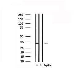 Invitrogen TRADD Polyclonal Antibody 100 μL; Unconjugated:Antibodies,