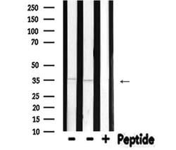 NeuroD1 Polyclonal Antibody:Antibodies, Polyclonal