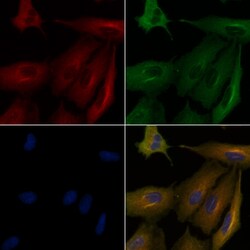 Invitrogen KCNE1 Polyclonal Antibody 100 μL; Unconjugated:Antibodies,