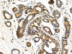 Invitrogen KCNE1 Polyclonal Antibody 100 μL; Unconjugated:Antibodies,