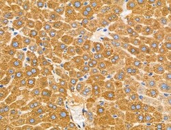 Invitrogen KCNE1 Polyclonal Antibody 100 μL; Unconjugated:Antibodies,