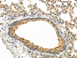Invitrogen KCNE1 Polyclonal Antibody 100 μL; Unconjugated:Antibodies,