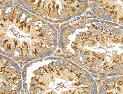 Invitrogen KCNE1 Polyclonal Antibody 100 μL; Unconjugated:Antibodies,