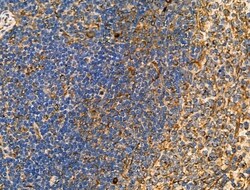 Invitrogen KCNE1 Polyclonal Antibody 100 μL; Unconjugated:Antibodies,
