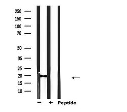 Invitrogen KCNE1 Polyclonal Antibody 100 μL; Unconjugated:Antibodies,