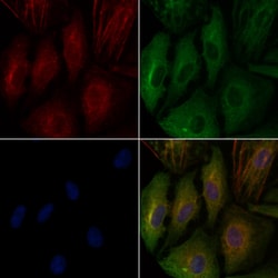Invitrogen CGA Polyclonal Antibody 100 &mu;L; Unconjugated:Antibodies,