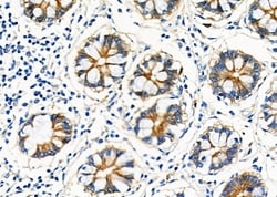 Invitrogen CGA Polyclonal Antibody 100 &mu;L; Unconjugated:Antibodies,