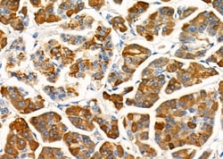 Invitrogen CGA Polyclonal Antibody 100 &mu;L; Unconjugated:Antibodies,