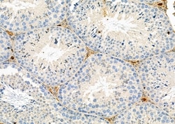 Invitrogen CGA Polyclonal Antibody 100 &mu;L; Unconjugated:Antibodies,