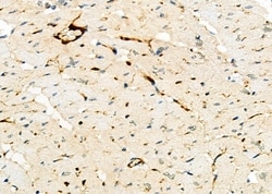 Invitrogen CGA Polyclonal Antibody 100 &mu;L; Unconjugated:Antibodies,