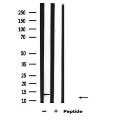 Invitrogen CGA Polyclonal Antibody 100 &mu;L; Unconjugated:Antibodies,