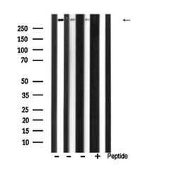 Invitrogen Factor VIII Polyclonal Antibody 100 &mu;L; Unconjugated:Antibodies,