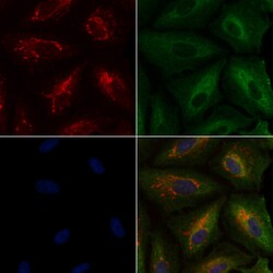 ABO Polyclonal Antibody, Invitrogen 100 &mu;L; Unconjugated:Antibodies,