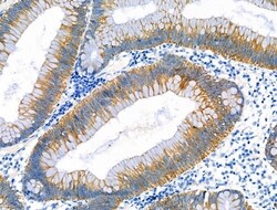 ABO Polyclonal Antibody, Invitrogen 100 &mu;L; Unconjugated:Antibodies,