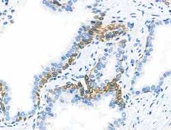 ABO Polyclonal Antibody, Invitrogen 100 &mu;L; Unconjugated:Antibodies,