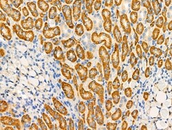 ABO Polyclonal Antibody, Invitrogen 100 &mu;L; Unconjugated:Antibodies,