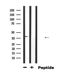 ABO Polyclonal Antibody, Invitrogen 100 &mu;L; Unconjugated:Antibodies,