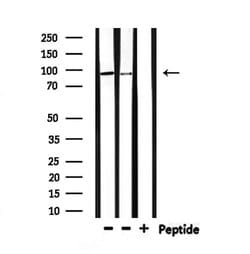 Invitrogen HMGCR Polyclonal Antibody 100 &mu;L; Unconjugated:Antibodies,