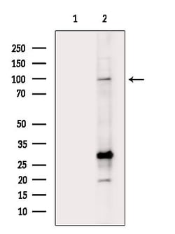 Invitrogen HMGCR Polyclonal Antibody 100 &mu;L; Unconjugated:Antibodies,
