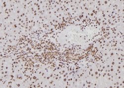 Invitrogen BTRC Polyclonal Antibody 100 &mu;L; Unconjugated:Antibodies,