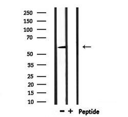 Invitrogen UGT1A9 Polyclonal Antibody 100 μL; Unconjugated:Antibodies,