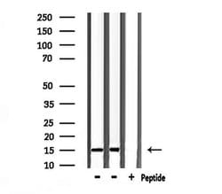 Invitrogen Substance P Polyclonal Antibody 100 &mu;L; Unconjugated:Antibodies,