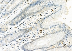 Invitrogen Complement Factor B Polyclonal Antibody 100 &mu;L; Unconjugated:Antibodies,