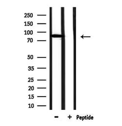 Invitrogen Complement Factor B Polyclonal Antibody 100 &mu;L; Unconjugated:Antibodies,