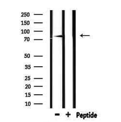 Invitrogen SCNN1B Polyclonal Antibody 100 &mu;L | Buy Online | Invitrogen&trade; | Fisher Scientific