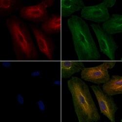 AKR1C3 Polyclonal Antibody:Antibodies, Polyclonal