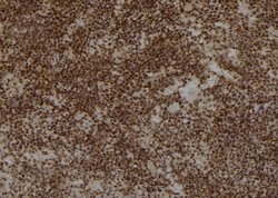 AKR1C3 Polyclonal Antibody:Antibodies, Polyclonal