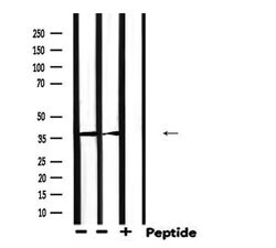 AKR1C3 Polyclonal Antibody:Antibodies, Polyclonal