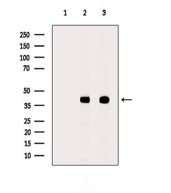 AKR1C3 Polyclonal Antibody:Antibodies, Polyclonal