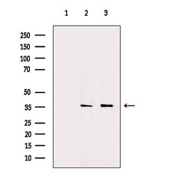 AKR1C3 Polyclonal Antibody:Antibodies, Polyclonal