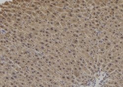 Invitrogen Dynactin 1 Polyclonal Antibody 100 &mu;L; Unconjugated:Antibodies,