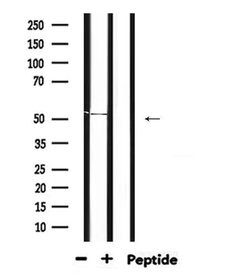 GABRA2 Polyclonal Antibody:Antibodies, Polyclonal