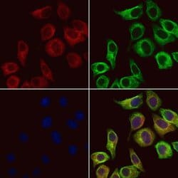 Invitrogen HSD3B2 Polyclonal Antibody 100 &mu;L | Buy Online | Invitrogen&trade; | Fisher Scientific