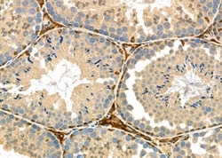 Invitrogen HSD3B2 Polyclonal Antibody 100 &mu;L | Buy Online | Invitrogen&trade; | Fisher Scientific
