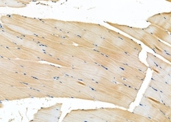 Invitrogen HSD3B2 Polyclonal Antibody 100 &mu;L | Buy Online | Invitrogen&trade; | Fisher Scientific