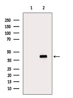 Invitrogen HSD3B2 Polyclonal Antibody 100 &mu;L | Buy Online | Invitrogen&trade; | Fisher Scientific