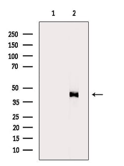 Invitrogen HSD3B2 Polyclonal Antibody 100 &mu;L | Buy Online | Invitrogen&trade; | Fisher Scientific