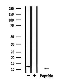 Invitrogen ROC1 Polyclonal Antibody 100 &mu;L; Unconjugated:Antibodies,