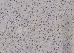 Invitrogen ATF3 Polyclonal Antibody 100 &mu;L; Unconjugated:Antibodies,