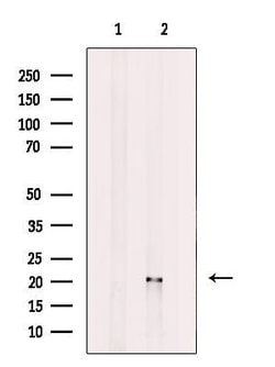 Invitrogen ATF3 Polyclonal Antibody 100 &mu;L; Unconjugated:Antibodies,