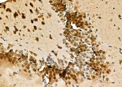 Invitrogen HSP701L Polyclonal Antibody 100 μL; Unconjugated:Antibodies,