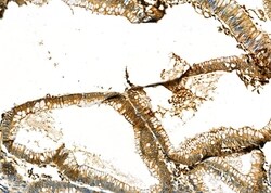 Invitrogen PRDX2 Polyclonal Antibody 100 &mu;L; Unconjugated:Antibodies,