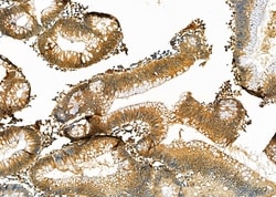 Invitrogen PRDX2 Polyclonal Antibody 100 &mu;L; Unconjugated:Antibodies,